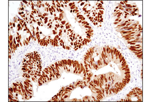 Immunohistochemistry Image 2: CDX2 (D11D10) Rabbit mAb (BSA and Azide Free)