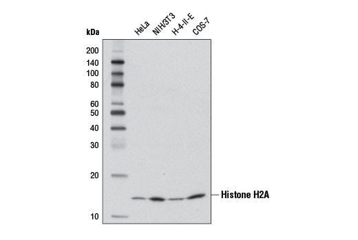  Image 1: Acetyl-Histone Antibody Sampler Kit