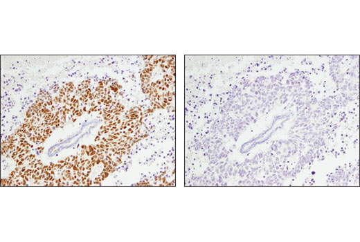  Image 44: BAF Complex Antibody Sampler Kit II