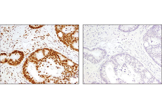  Image 26: Acetyl-Histone Antibody Sampler Kit