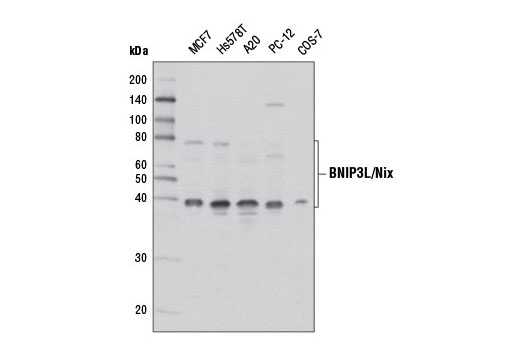  Image 11: Mitophagy Antibody Sampler Kit