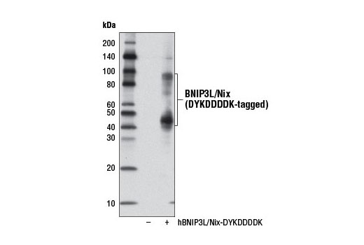  Image 18: Mitophagy Antibody Sampler Kit
