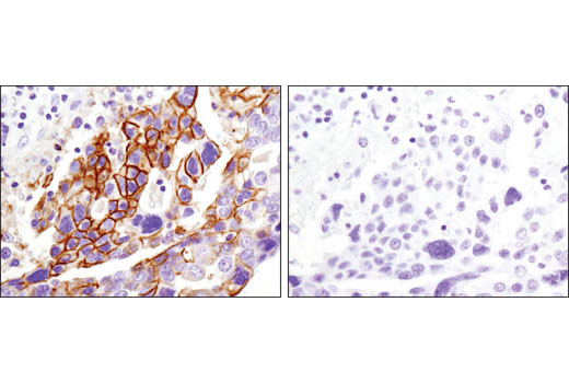 Immunohistochemistry Image 3: CD82 (D7G6H) Rabbit mAb