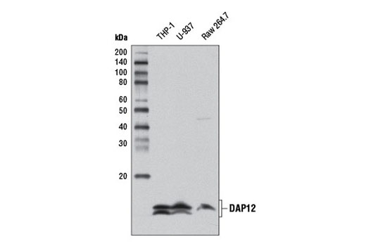  Image 8: TREM2 Signaling Pathways Antibody Sampler Kit