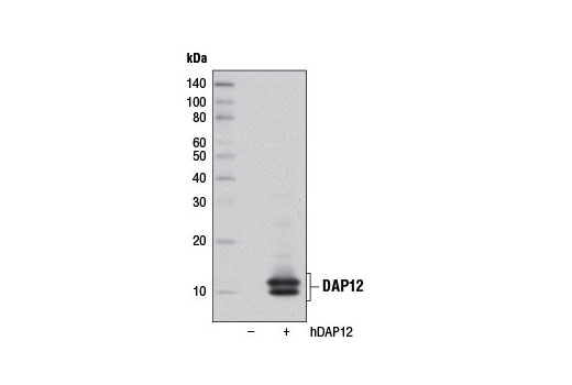  Image 21: TREM2 Signaling Pathways Antibody Sampler Kit