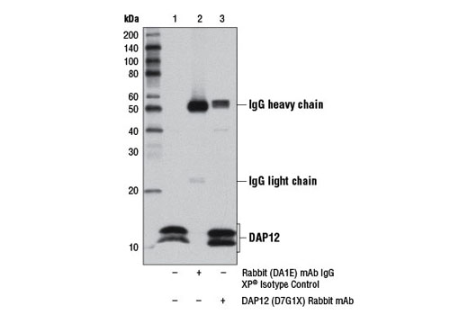  Image 26: TREM2 Signaling Pathways Antibody Sampler Kit