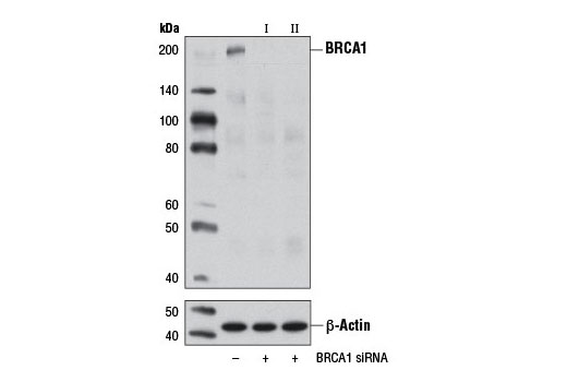  Image 1: SignalSilence® BRCA1 siRNA I