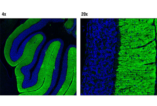 Immunofluorescence Image 1: mGluR1 (D5H10) Rabbit mAb