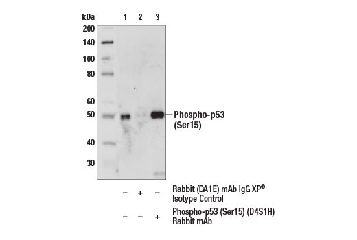 Immunoprecipitation Image 1: Phospho-p53 (Ser15) (D4S1H) Rabbit mAb