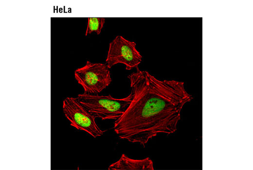 Immunofluorescence Image 1: HEXIM1 (D5Y5K) Rabbit mAb