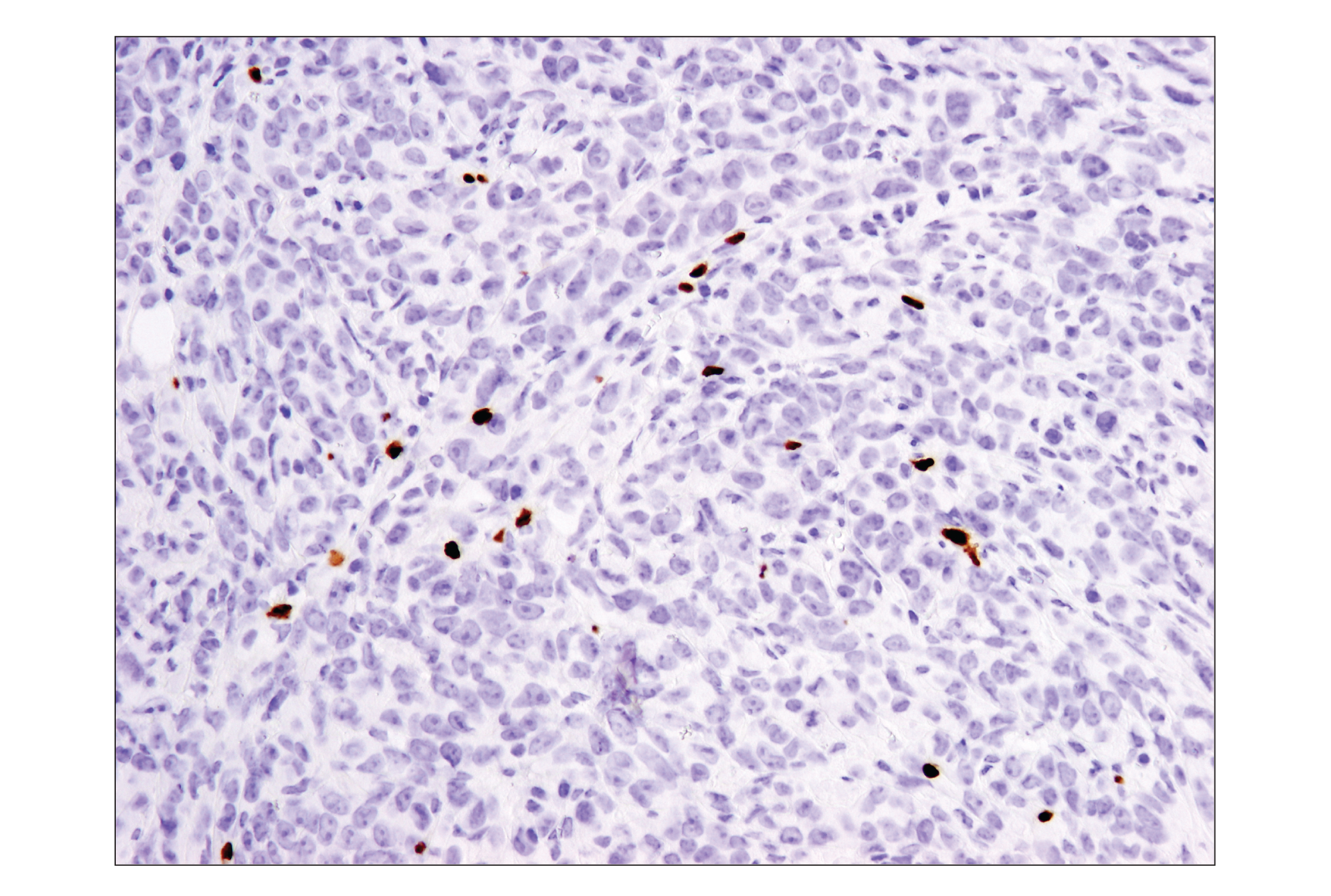Immunohistochemistry Image 1: FoxP3 (D6O8R) Rabbit mAb