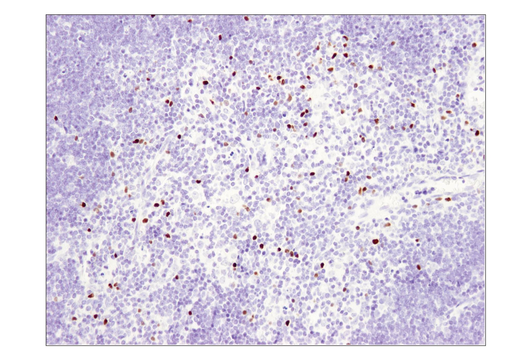 Immunohistochemistry Image 2: FoxP3 (D6O8R) Rabbit mAb