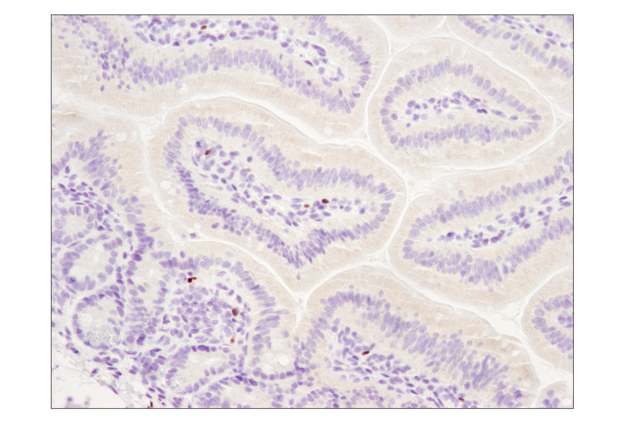 Immunohistochemistry Image 4: FoxP3 (D6O8R) Rabbit mAb