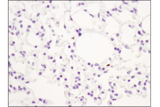  Image 33: Mouse Immune Cell Phenotyping IHC Antibody Sampler Kit