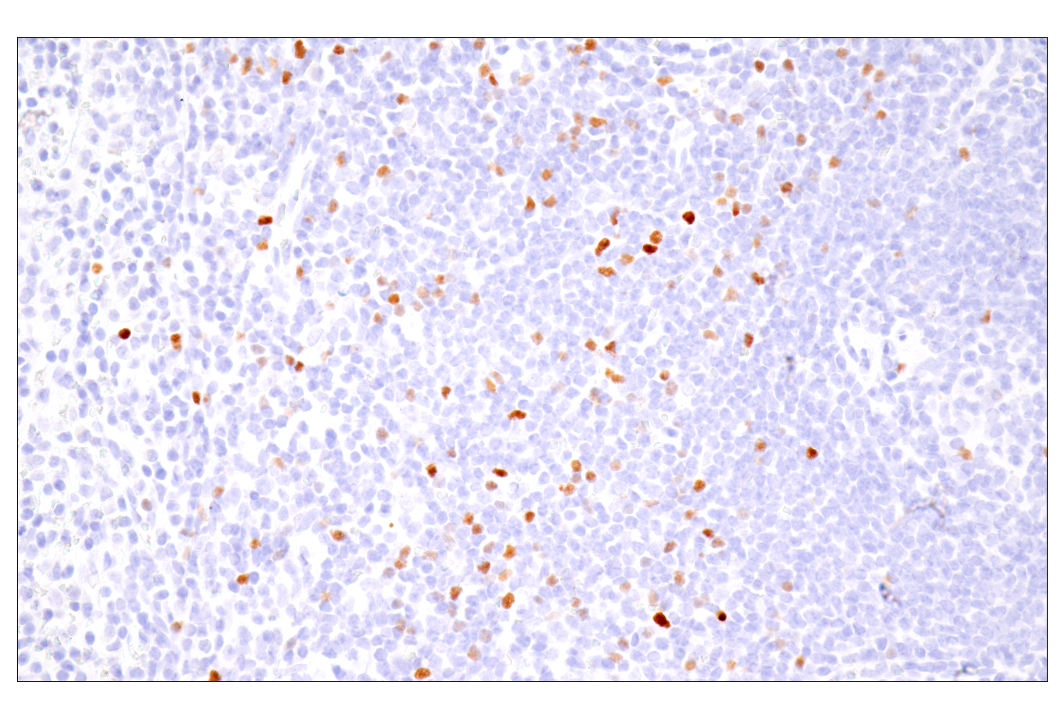 Immunohistochemistry Image 6: FoxP3 (D6O8R) Rabbit mAb