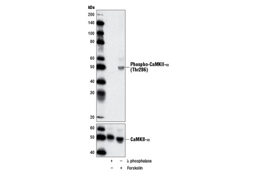  Image 1: PhosphoPlus® CaMKII (Thr286) Antibody Duet