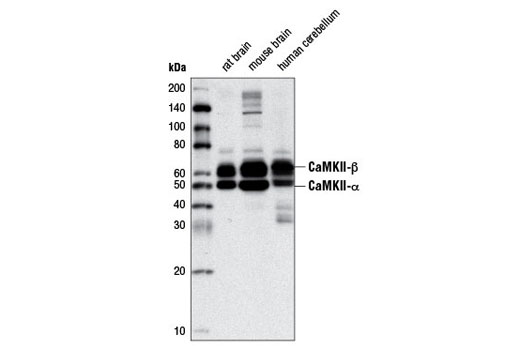  Image 3: PhosphoPlus® CaMKII (Thr286) Antibody Duet