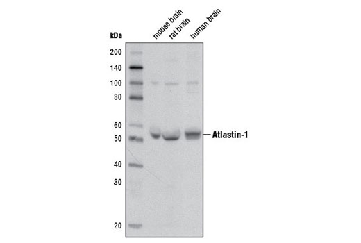 Western Blotting Image 2: Atlastin-1 (D2E6) Rabbit mAb