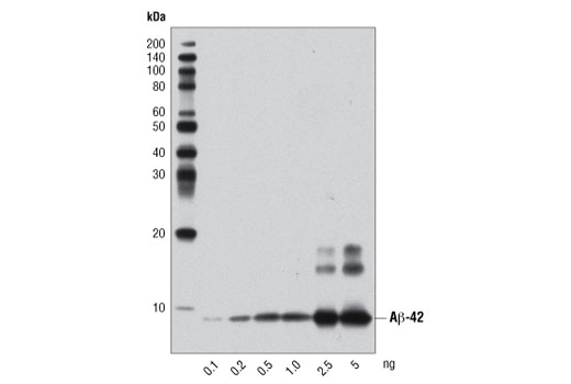  Image 11: β-Amyloid Antibody Sampler Kit