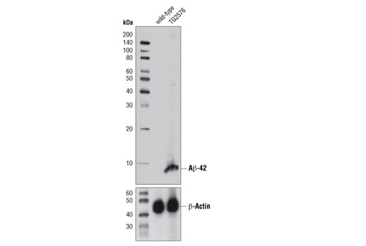 Western Blotting Image 3: β-Amyloid (1-42) (D3E10) Rabbit mAb