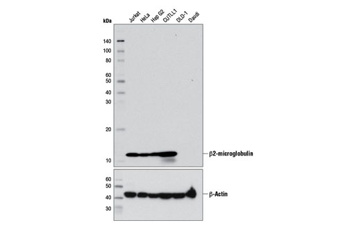 Western Blotting Image 1: β2-microglobulin (D8P1H) Rabbit mAb