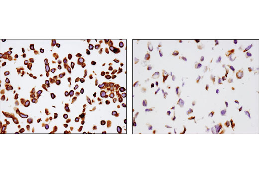 Immunohistochemistry Image 2: MRP4/ABCC4 (D1Z3W) Rabbit mAb