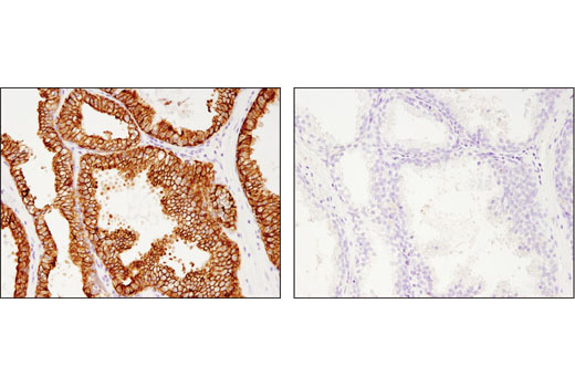 Immunohistochemistry Image 3: MRP4/ABCC4 (D1Z3W) Rabbit mAb