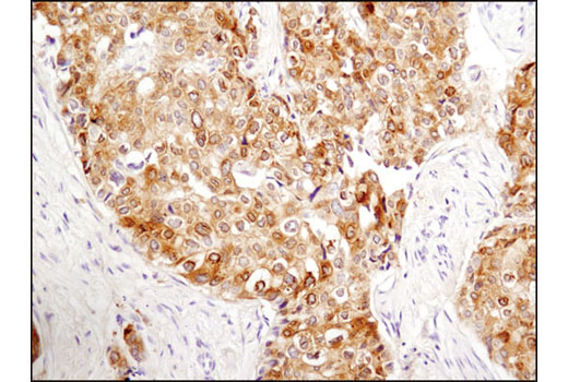  Image 33: LRP1-mediated Endocytosis and Transmission of Tau Antibody Sampler Kit