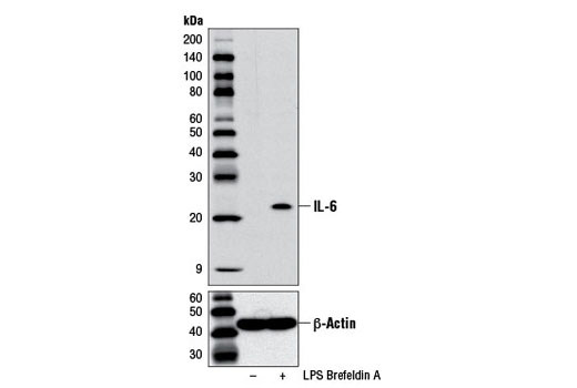  Image 5: Mouse Reactive Senescence Associated Secretory Phenotype (SASP) Antibody Sampler Kit