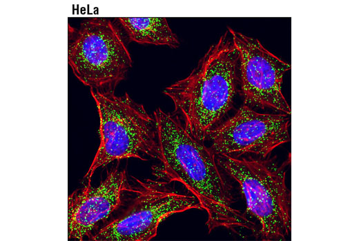 Immunofluorescence Image 1: Catalase (D4P7B) XP® Rabbit mAb