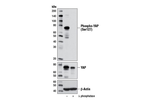  Image 8: PhosphoPlus® YAP (Ser127) Antibody Duet