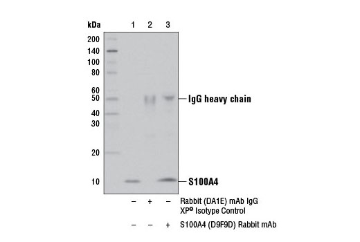  Image 19: Cancer Associated Fibroblast Marker Antibody Sampler Kit