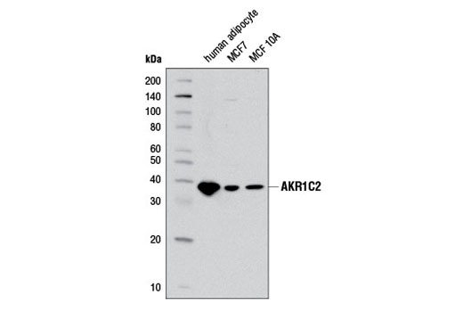 Western Blotting Image 1: AKR1C2 Antibody