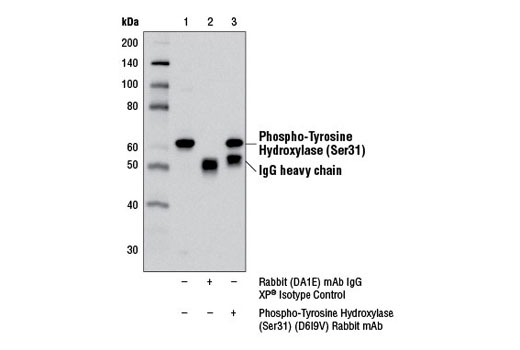 Immunoprecipitation Image 1: Phospho-Tyrosine Hydroxylase (Ser31) (D6I9V) Rabbit mAb