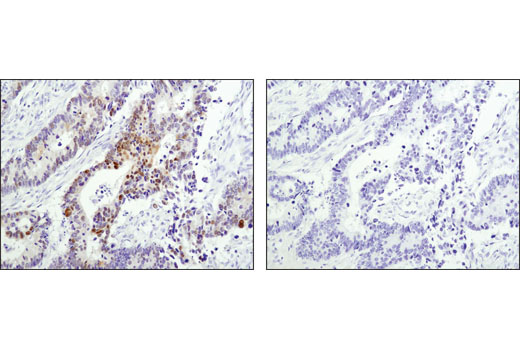 Immunohistochemistry Image 3: Wee1 (D10D2) Rabbit mAb (BSA and Azide Free)