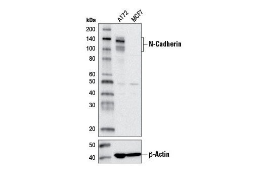  Image 3: Cadherin-Catenin Antibody Sampler Kit