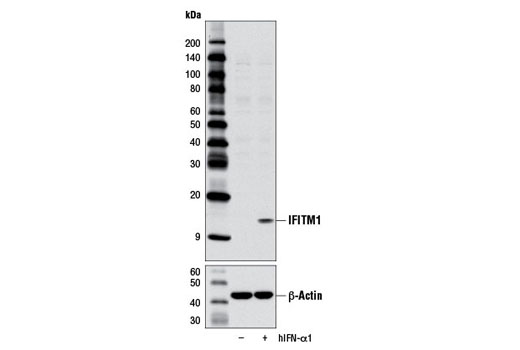  Image 21: Host Cell Viral Restriction Factor Antibody Sampler Kit