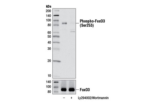  Image 2: Forkhead Signaling Antibody Sampler Kit