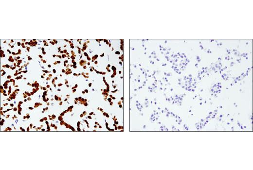  Image 30: Mature Neuron Marker Antibody Sampler Kit