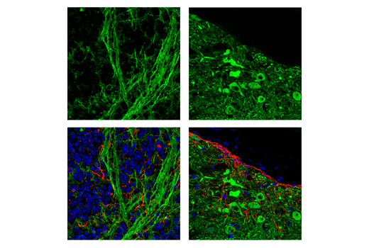 Image 44: Mature Neuron Marker Antibody Sampler Kit