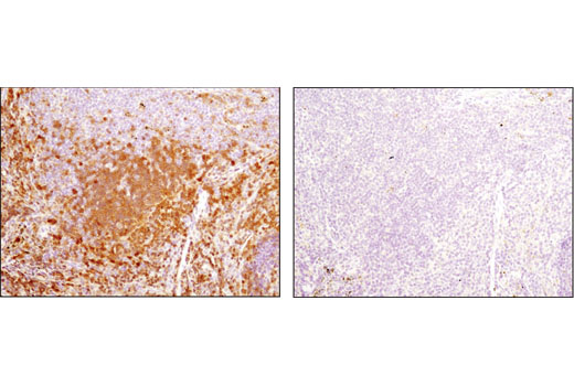  Image 28: B Cell Signaling Antibody Sampler Kit II