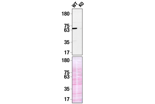  Image 13: Human TREM2 Activity Antibody Sampler Kit