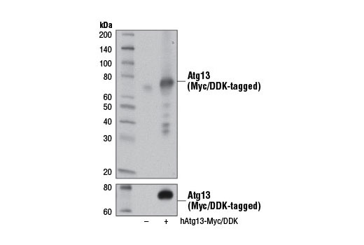  Image 11: ULK1 Substrate Antibody Sampler Kit