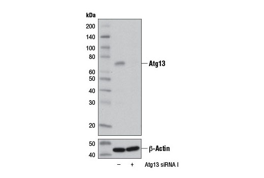  Image 21: ULK1 Substrate Antibody Sampler Kit