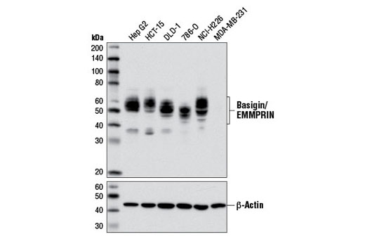  Image 2: Coronavirus Host Cell Attachment and Entry Antibody Sampler Kit