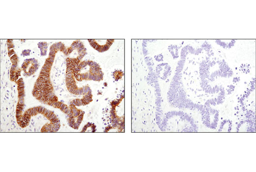  Image 25: Coronavirus Host Cell Attachment and Entry Antibody Sampler Kit