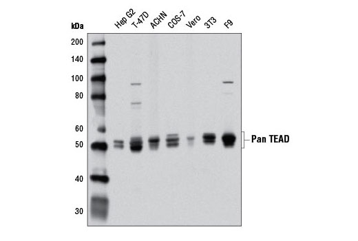  Image 21: YAP/TAZ Transcriptional Targets Antibody Sampler Kit