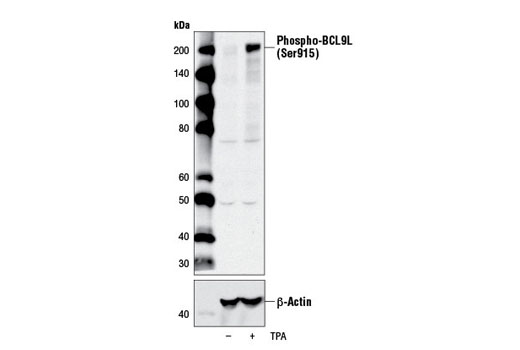 Western Blotting Image 1: Phospho-BCL9L (Ser915) Antibody