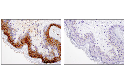  Image 34: LRP1-mediated Endocytosis and Transmission of Tau Antibody Sampler Kit