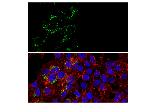  Image 45: LRP1-mediated Endocytosis and Transmission of Tau Antibody Sampler Kit